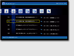 SmartVision